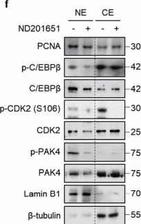 Fig.5.T showing Western Blotting from the publication: PAK4 phosphorylates cyclin-dependent kinase 2 to promote the G1/S transition during adipogenesis.