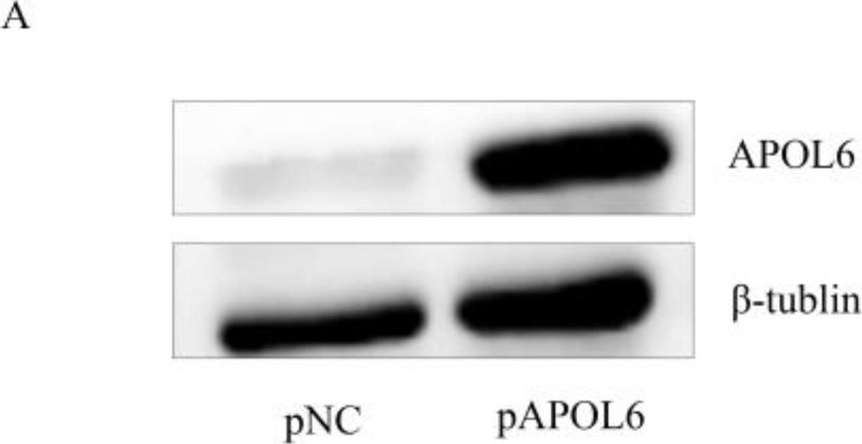 Fig.5.A showing Western Blotting in a Homo sapiens (Human) sample from the publication: Upregulation of Apolipoprotein L6 Improves Tumor Immunotherapy by Inducing Immunogenic Cell Death.