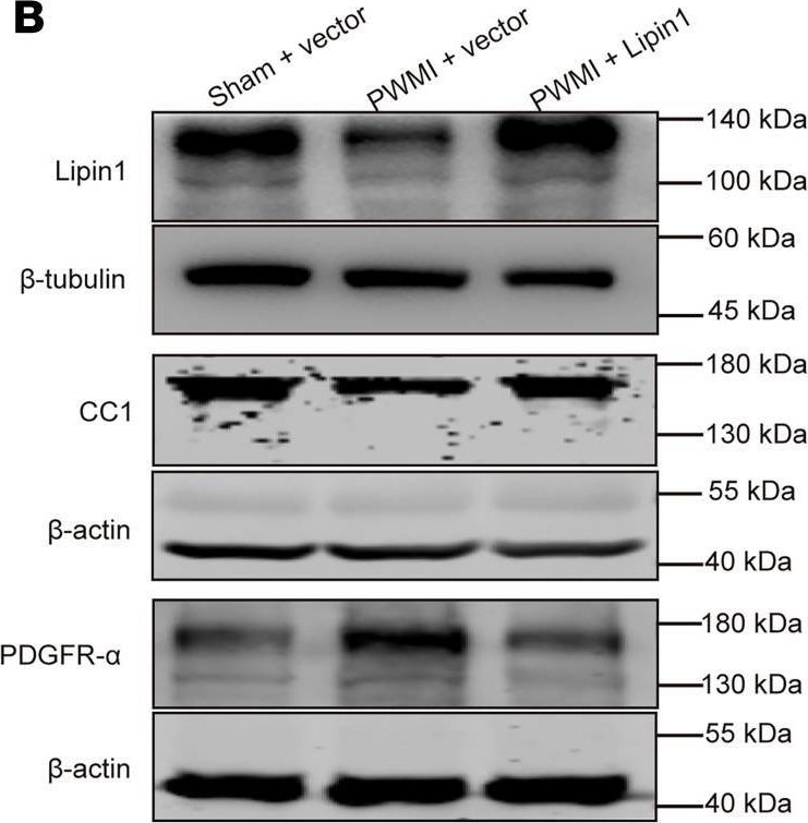 Fig.4.B showing Western Blotting in a Mus musculus (House mouse) sample from the publication: NAT10-mediated ac4C modification of Lipin1 mRNA contributes to the pathogenesis of PWMI.