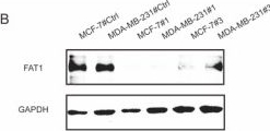 Fig.5.B showing Western Blotting from the publication: Loss of FAT1 drives cyclophosphamide resistance in breast cancer via the Wnt/β-Catenin pathway.