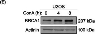 Fig.5.E showing Western Blotting in a Homo sapiens (Human) sample from the publication: β-TrCP overexpression enhances cisplatin sensitivity by depleting BRCA1.