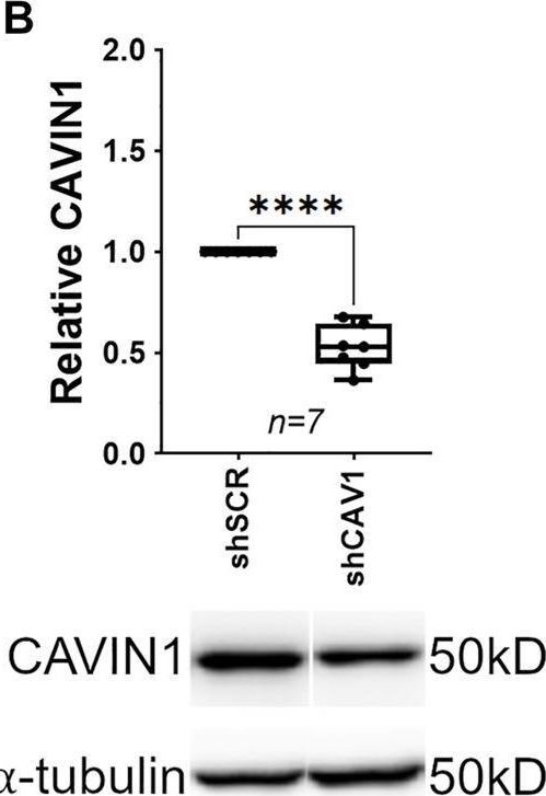 Fig.1.B showing Western Blotting in a Mus musculus (House mouse) sample from the publication: A Role of Caveolae in Trabecular Meshwork Mechanosensing and Contractile Tone.