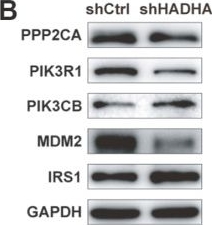 Fig.6.B showing Western Blotting from the publication: HADHA promotes esophageal cancer progression by activating mTOR signaling and the SP1/MDM2 axis.