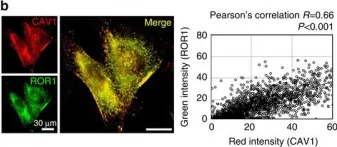 Fig.3.B showing Immunocytochemistry-immunofluorescence in a Homo sapiens (Human) sample from the publication: ROR1 sustains caveolae and survival signalling as a scaffold of cavin-1 and caveolin-1.