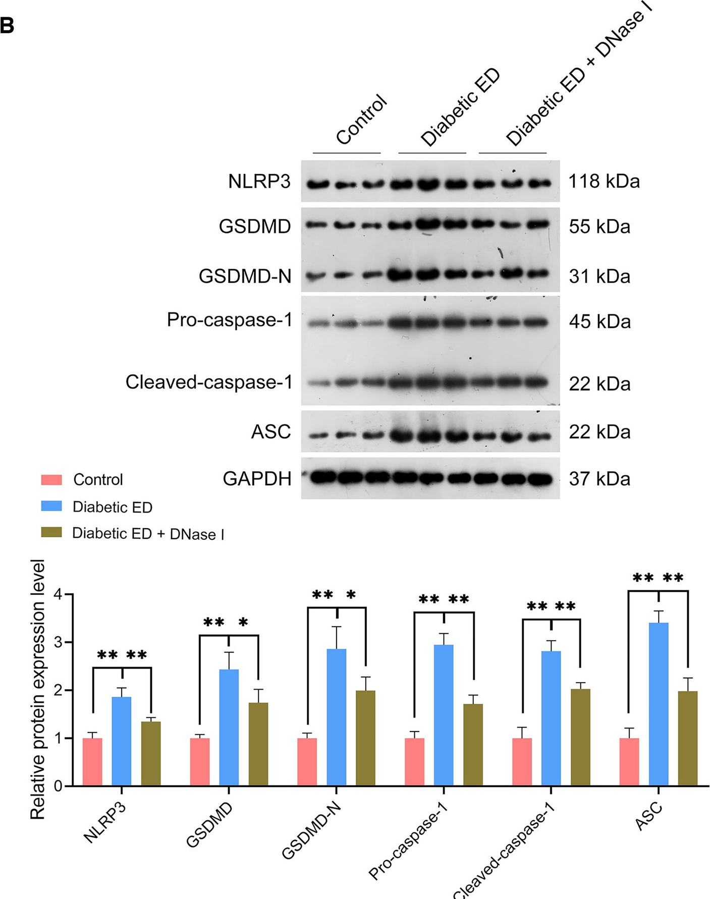 Fig.5.B showing Western Blotting from the publication: Neutrophil extracellular traps promote erectile dysfunction in rats with diabetes mellitus by enhancing NLRP3-mediated pyroptosis.