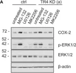 Fig.6.A showing Western Blotting from the publication: TRAIL-Receptor 4 Modulates γδ T Cell-Cytotoxicity Toward Cancer Cells.