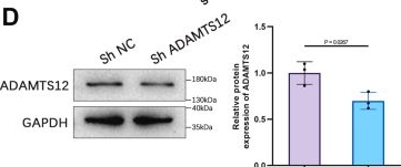 Fig.3.D showing Western Blotting from the publication: Unveiling ADAMTS12: A key driver of bladder cancer progression via COL3A1-Mediated activation of the FAK/PI3K/AKT signaling pathway.