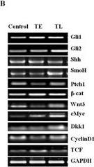 Fig.5.B showing Western Blotting in a Homo sapiens (Human) sample from the publication: The molecular connection of histopathological heterogeneity in hepatocellular carcinoma: A role of Wnt and Hedgehog signaling pathways.