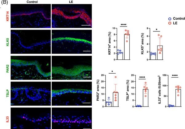 Fig.2.B showing Immunohistochemistry-immunofluorescence in a Mus musculus (House mouse) sample from the publication: Critical role of keratinocytes and protease-activated receptor 2 in secondary lymphedema development.