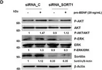 Fig.7.D showing Western Blotting in a Homo sapiens (Human) sample from the publication: p75 neurotrophin receptor and pro-BDNF promote cell survival and migration in clear cell renal cell carcinoma.