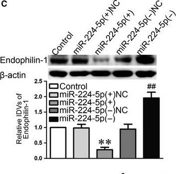 Fig.5.C showing Western Blotting in a Homo sapiens (Human) sample from the publication: The role of LINC00094/miR-224-5p (miR-497-5p)/Endophilin-1 axis in Memantine mediated protective effects on blood-brain barrier in AD microenvironment.
