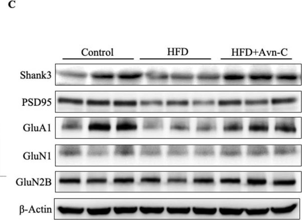 Fig.5.C showing Western Blotting from the publication: Avenanthramide-C Mitigates High-Fat Diet-Accelerated Alzheimer's Pathologies via NOD1-Driven Neuroinflammation in 5×FAD Mice.