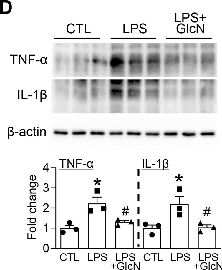 Fig.5.D showing Western Blotting in a Mus musculus (House mouse) sample from the publication: O-GlcNAcylation reprograms microglial inflammatory states and attenuates Alzheimer's disease pathology.