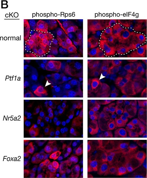 Fig.3.B showing Immunocytochemistry-immunofluorescence in a Mus musculus (House mouse) sample from the publication: Key transcriptional effectors of the pancreatic acinar phenotype and oncogenic transformation.