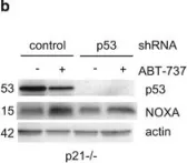 Fig.2.B showing Western Blotting in a Homo sapiens (Human) sample from the publication: Constitutive p53 heightens mitochondrial apoptotic priming and favors cell death induction by BH3 mimetic inhibitors of BCL-xL.