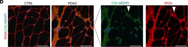 Fig.3.D showing Immunohistochemistry-immunofluorescence from the publication: Complement pathway activation mediates pancreatic cancer-induced muscle wasting and pathological remodeling.
