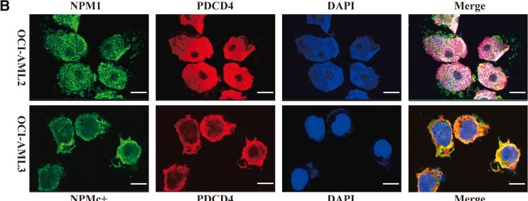 Fig.3.B showing Immunocytochemistry-immunofluorescence from the publication: Mutant NPM1 modulates PDCD4 ubiquitination degradation and facilitates leukemogenesis.