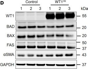 Fig.5.D showing Western Blotting from the publication: Wilms tumor 1 impairs apoptotic clearance of fibroblasts in distal fibrotic lung lesions.