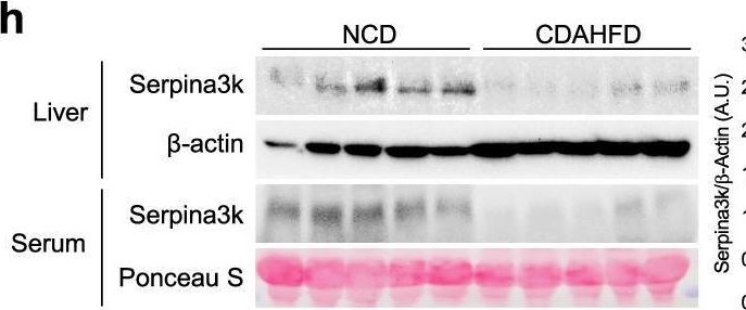 Fig.3.H showing Western Blotting from the publication: Hepatocyte KCTD17-mediated SERPINA3 inhibition determines liver fibrosis in metabolic dysfunction-associated steatohepatitis.