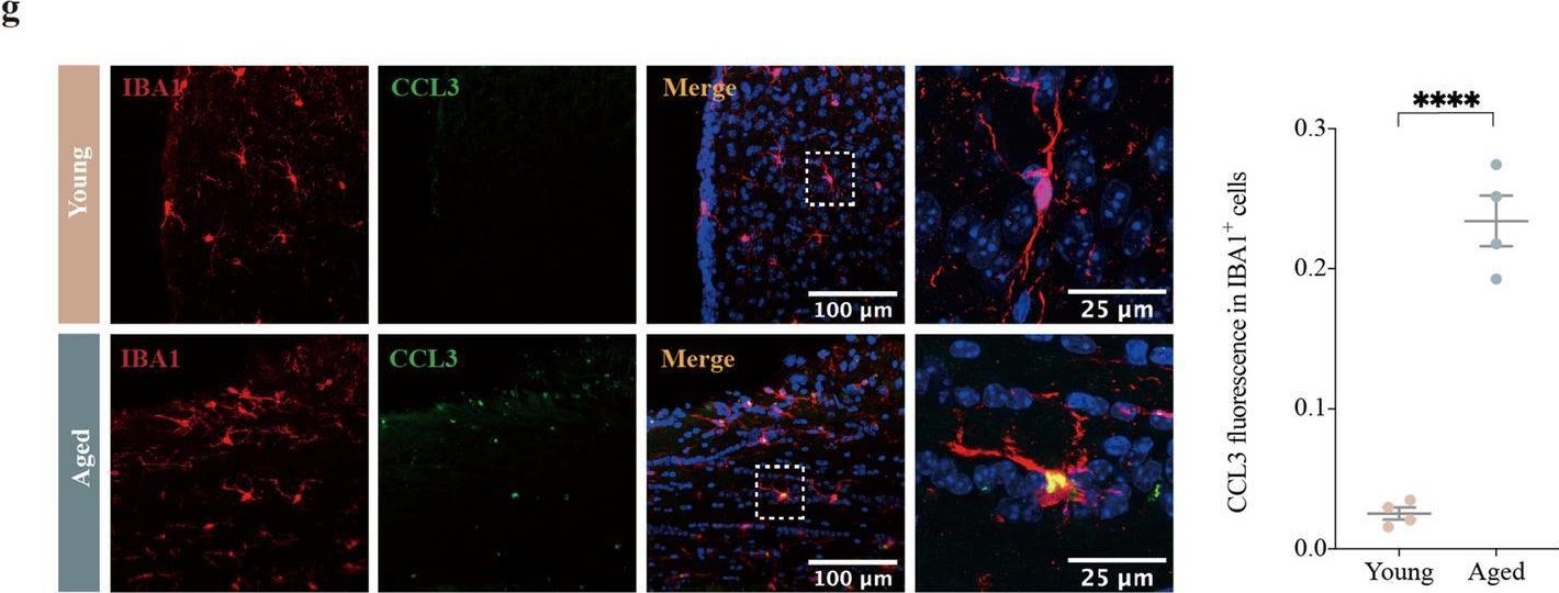 Fig.2.G showing Immunohistochemistry-immunofluorescence in a Mus musculus (House mouse) sample from the publication: Aged microglia promote peripheral T cell infiltration by reprogramming the microenvironment of neurogenic niches.