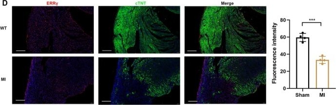 Fig.1.D showing Immunohistochemistry-immunofluorescence in a Mus musculus (House mouse) sample from the publication: Nuclear Receptor ERRγ Protects Against Cardiac Ischemic Injury by Suppressing GBP5-Mediated Myocardial Inflammation.