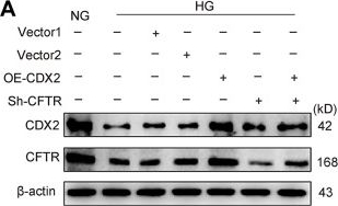 Fig.6.A showing Western Blotting from the publication: The role of CDX2 in renal tubular lesions during diabetic kidney disease.