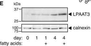Fig.2.E showing Western Blotting in a Mus musculus (House mouse) sample from the publication: LPAAT3 incorporates docosahexaenoic acid into skeletal muscle cell membranes and is upregulated by PPARδ activation.