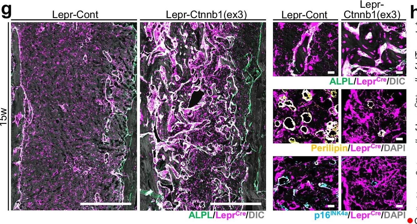 Fig.9.G showing Immunohistochemistry-immunofluorescence in a Spider sample from the publication: Injury-driven stromal exhaustion disrupts intrinsic regenerative capability.