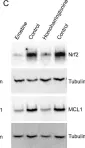 Fig.8.C showing Western Blotting in a Mus musculus (House mouse) sample from the publication: Increased expression of the tight junction protein TJP1/ZO-1 is associated with upregulation of TAZ-TEAD activity and an adult tissue stem cell signature in carfilzomib-resistant multiple myeloma cells and high-risk multiple myeloma patients.