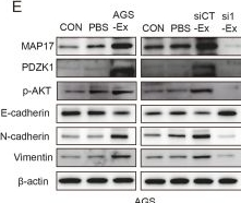 Fig.6.E showing Western Blotting in a Homo sapiens (Human) sample from the publication: Exosomal LINC00853 promotes progression of gastric cancer via the MAP17/PDZK1/AKT signaling pathway.