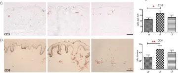 Fig.1.C showing Immunohistochemistry in a Homo sapiens (Human) sample from the publication: Th17 cells and activated dendritic cells are increased in vitiligo lesions.