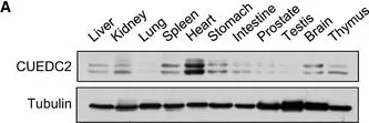Fig.1.A showing Western Blotting in a Mus musculus (House mouse) sample from the publication: CUEDC2 modulates cardiomyocyte oxidative capacity by regulating GPX1 stability.