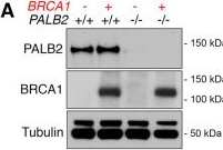 Fig.6.A showing Western Blotting from the publication: Genetic separation of Brca1 functions reveal mutation-dependent Polθ vulnerabilities.