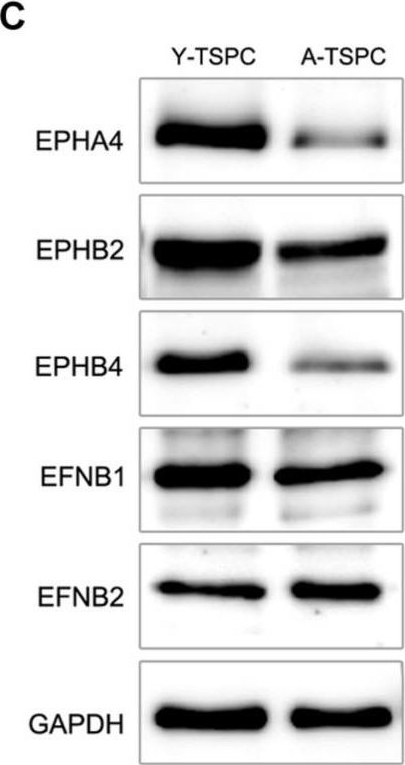 Fig.1.C showing Western Blotting from the publication: Activation of EphA4 and EphB2 Reverse Signaling Restores the Age-Associated Reduction of Self-Renewal, Migration, and Actin Turnover in Human Tendon Stem/Progenitor Cells.