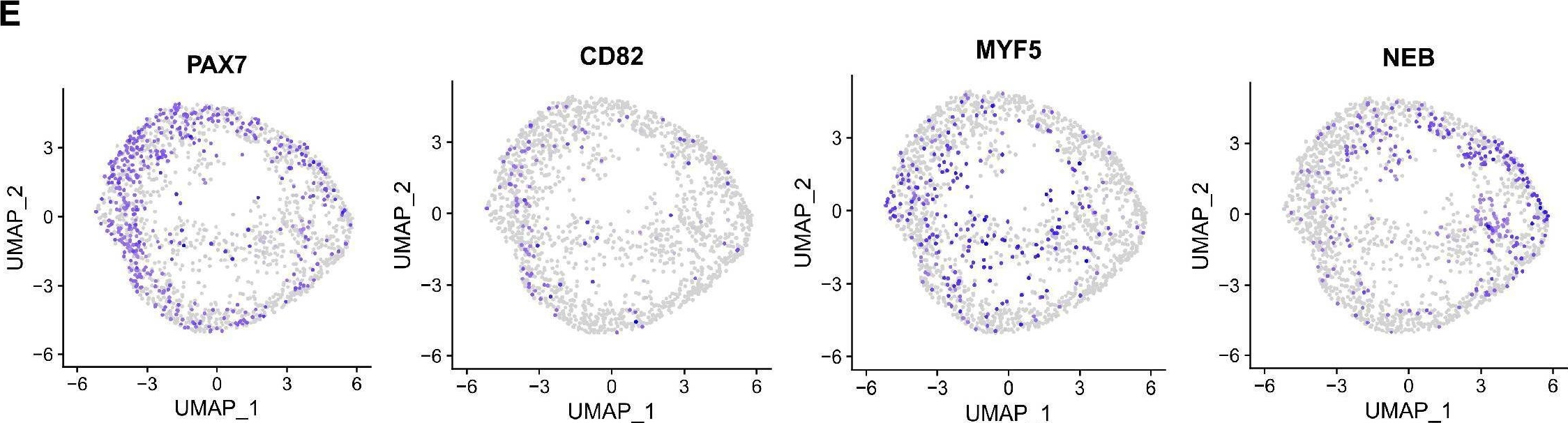 Fig.4.E showing Immunohistochemistry from the publication: Human skeletal muscle organoids model fetal myogenesis and sustain uncommitted PAX7 myogenic progenitors.