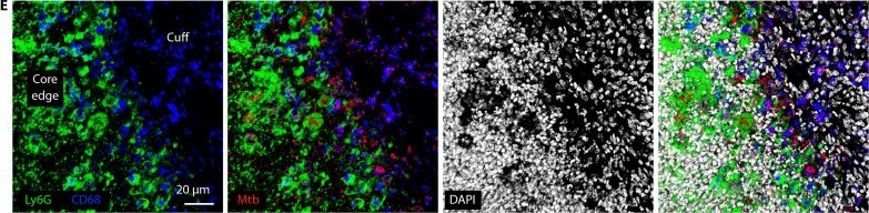 Fig.2.E showing Immunohistochemistry-immunofluorescence in a Mus musculus (House mouse) sample from the publication: Direct bacterial transcript visualization illuminates spatiotemporal environmental adaptation of Mycobacterium tuberculosis in the lung.