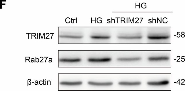 Fig.6.F showing Western Blotting from the publication: TRIM27-controlled endothelium-derived exosomes play a central role in podocyte injury in diabetic kidney disease.