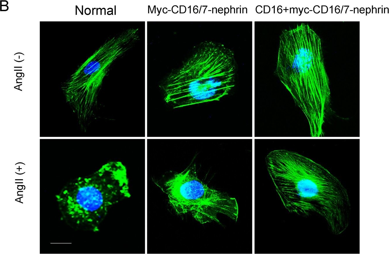 Role of c-Abl and nephrin in podocyte cytoskeletal remodeling induced by angiotensin II.