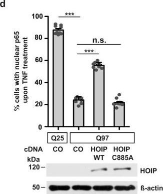 Fig.5.D showing Western Blotting in a Mus musculus (House mouse) sample from the publication: NEMO reshapes the α-Synuclein aggregate interface and acts as an autophagy adapter by co-condensation with p62.