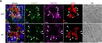 Fig.7.A showing Immunohistochemistry-immunofluorescence from the publication: HPS1 Regulates the Maturation of Large Dense Core Vesicles and Lysozyme Secretion in Paneth Cells.
