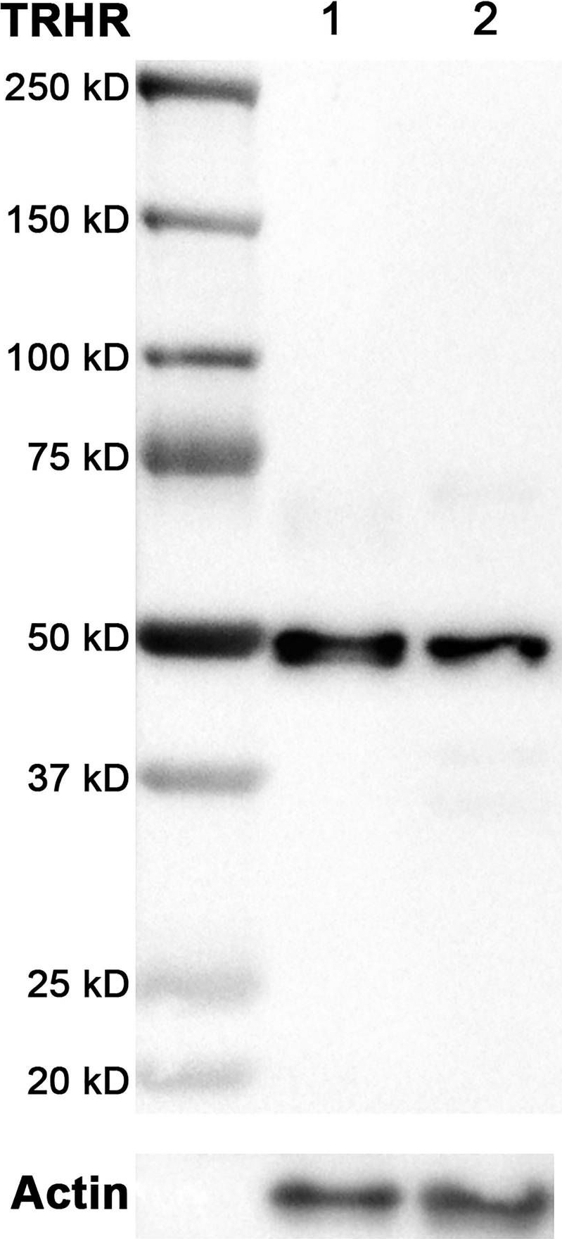 Fig.3.A showing Western Blotting in a Canis lupus familiaris (Domestic dog) sample from the publication: TRH-induced secretion of adrenocorticotropin and cortisol in dogs with pituitary-dependent hypercortisolism.