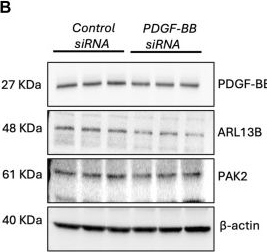 Fig.6.B showing Western Blotting from the publication: Brain vascular stability relies on PAK2-cilia-PDGF-BB-HSPGs on basolateral side of endothelium.