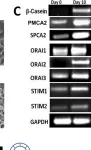 Fig.3.C showing Western Blotting in a Mus musculus (House mouse) sample from the publication: SPCA2 regulates Orai1 trafficking and store independent Ca2+ entry in a model of lactation.