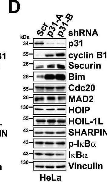 Fig.4.D showing Western Blotting in a Homo sapiens (Human) sample from the publication: Linear ubiquitination of p31comet by HOIP couples cytokine response with mitotic regulation.