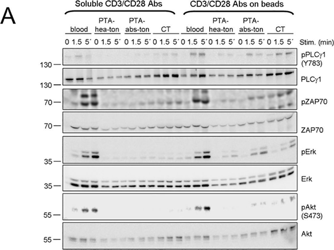 Fig.6.A showing Western Blotting in a Homo sapiens (Human) sample from the publication: Functional characterization of T-cells from palatine tonsils in patients with chronic tonsillitis.