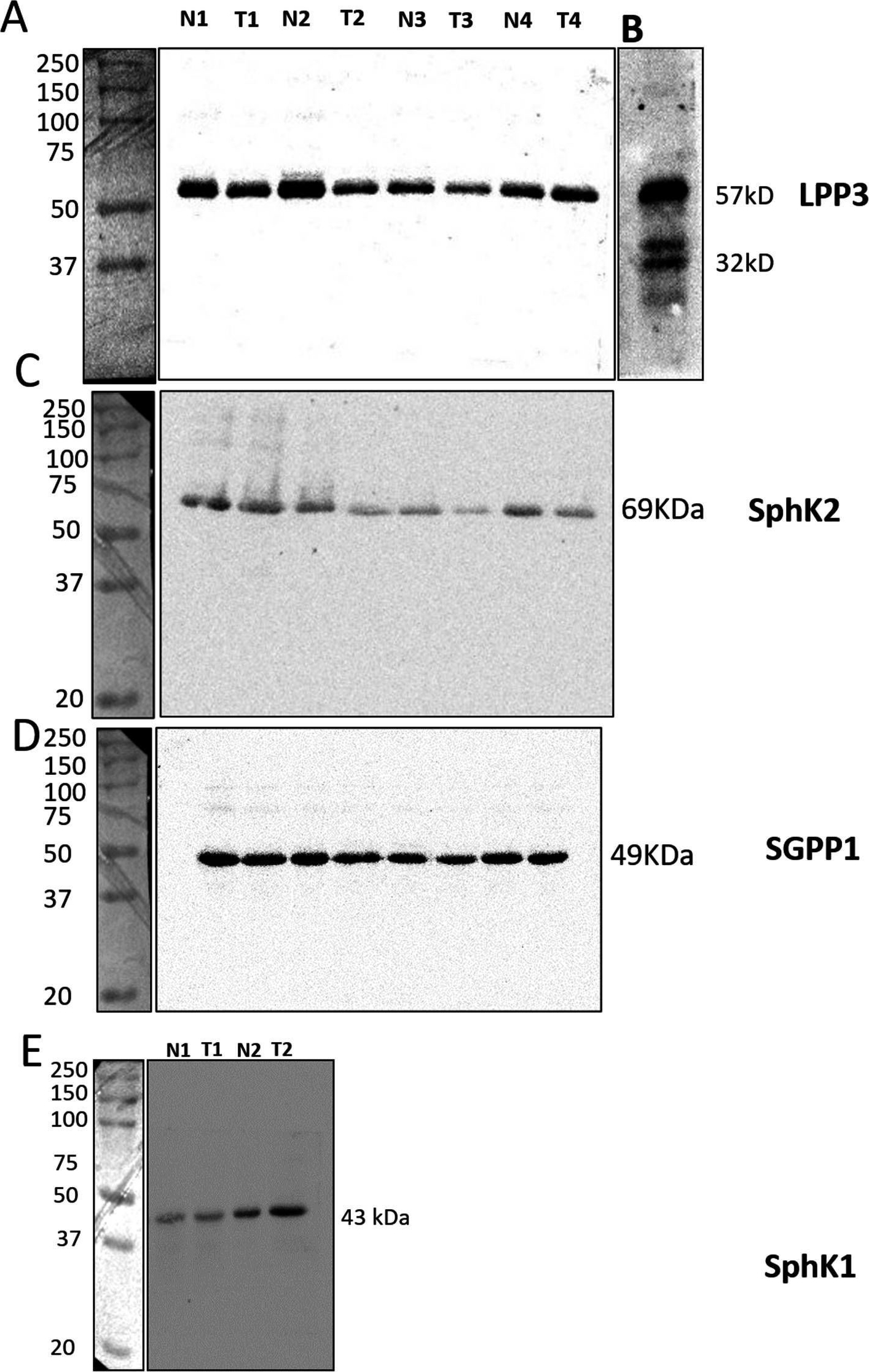 Fig.1.A showing Western Blotting from the publication: Downregulation of Lipid Phosphate Phosphatase 3 Correlates With Tumor-Infiltrating Immune Cells in Oral Cancer.