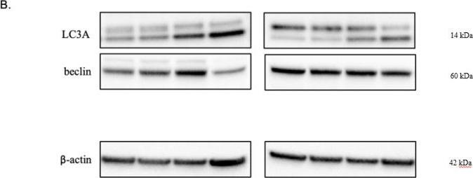 Fig.3.B showing Western Blotting from the publication: Mebendazole Shows Antiproliferative and Antimigratory Effects in Paediatric Low-Grade Glioma Models.