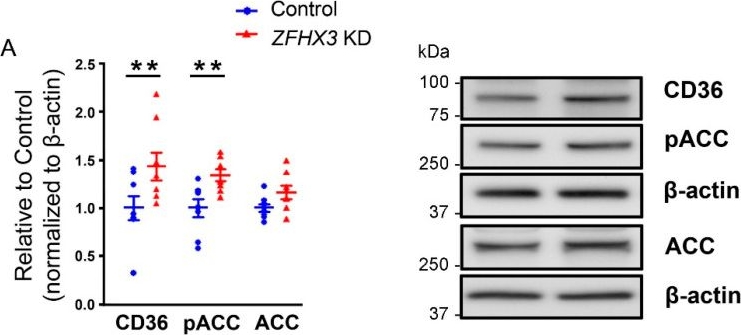 Fig.3.A showing Western Blotting in a Mus musculus (House mouse) sample from the publication: ZFHX3 Knockdown Enhances Metabolic Distress in Atrial Myocytes Through Mitochondrial and Calcium Dysregulation: Mitigation by Trimetazidine.