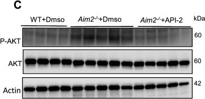 Fig.8.C showing Western Blotting from the publication: AIM2 enhances Candida albicans infection through promoting macrophage apoptosis via AKT signaling.