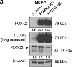 Fig.4.A showing Western Blotting in a Homo sapiens (Human) sample from the publication: SUMOylation modulates FOXK2-mediated paclitaxel sensitivity in breast cancer cells.